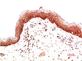 Collagen I Mouse Monoclonal Antibody(6E11)