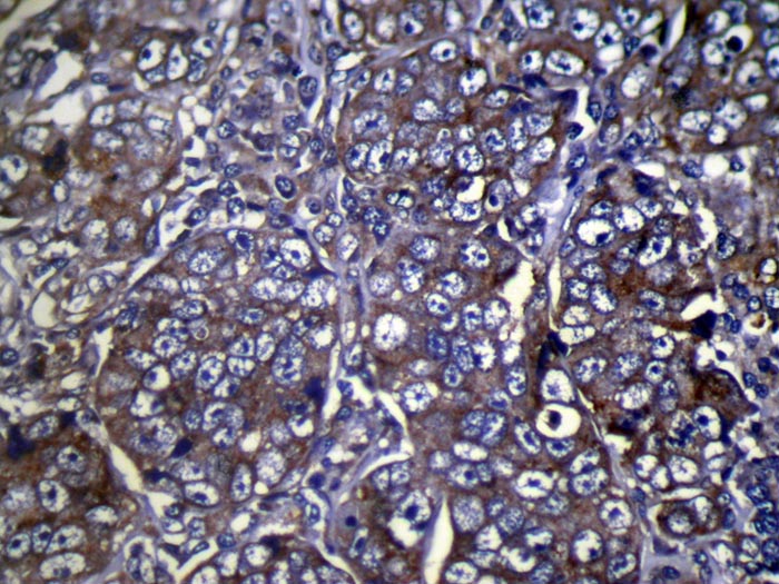 COLEC11 Antibody