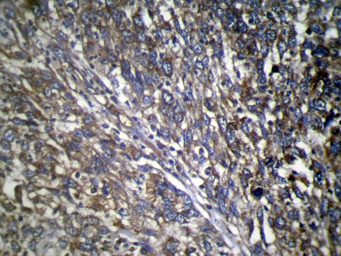 TWF1 Antibody