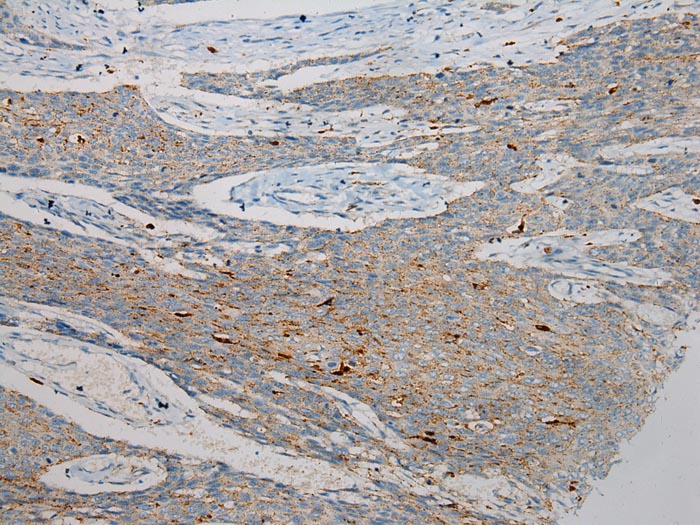 SCPEP1 Antibody