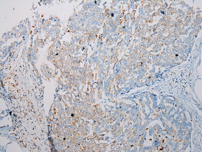 SCPEP1 Antibody