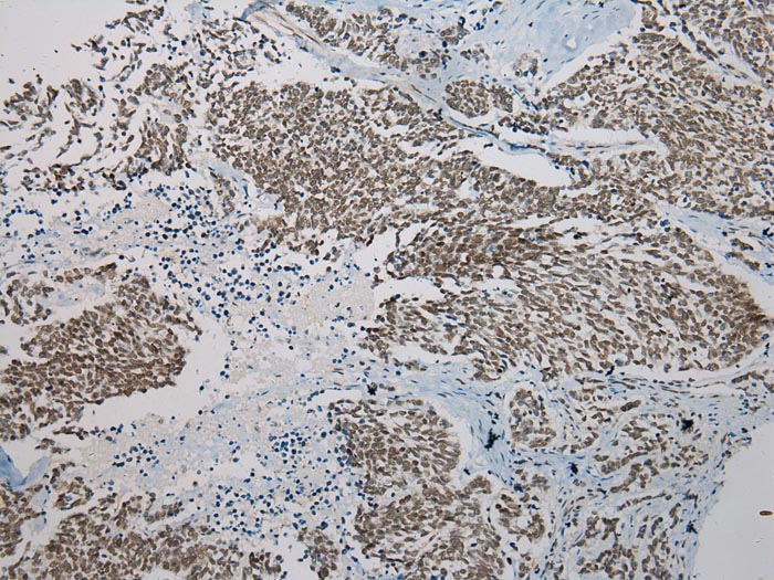 SERPINB8 Antibody