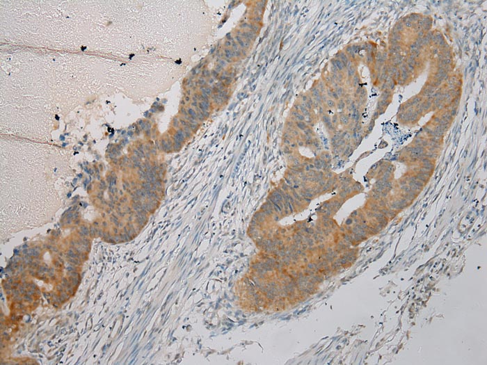 ARMC10 Antibody