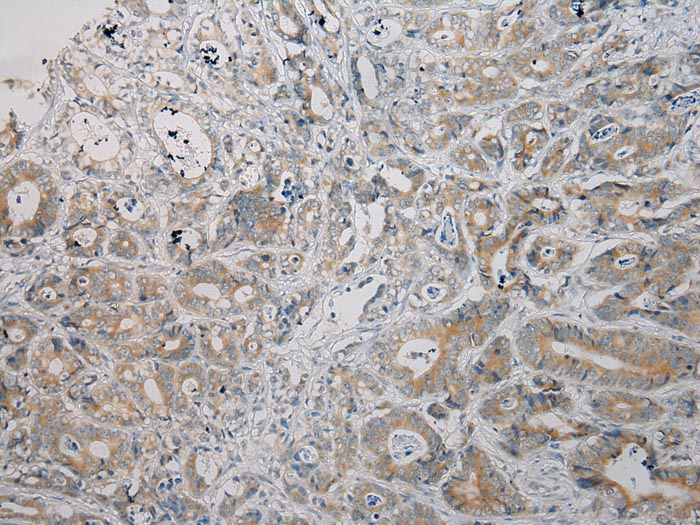 ARMC10 Antibody