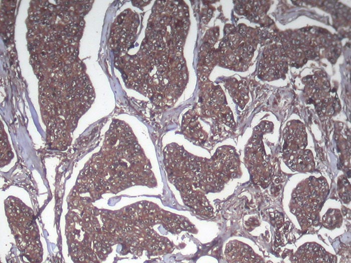 SRGAP1 Antibody