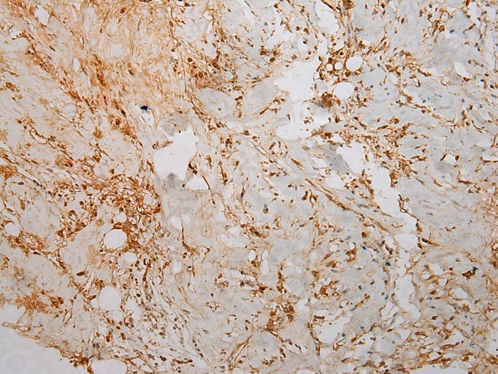 TMPRSS11F Antibody