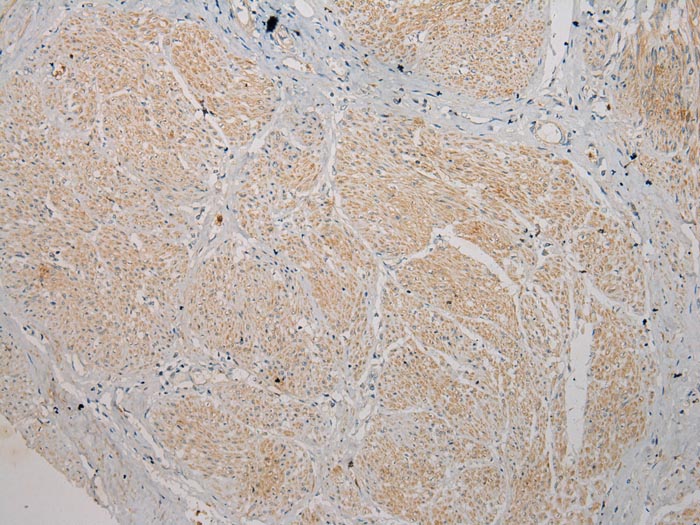 TSPY1 Antibody