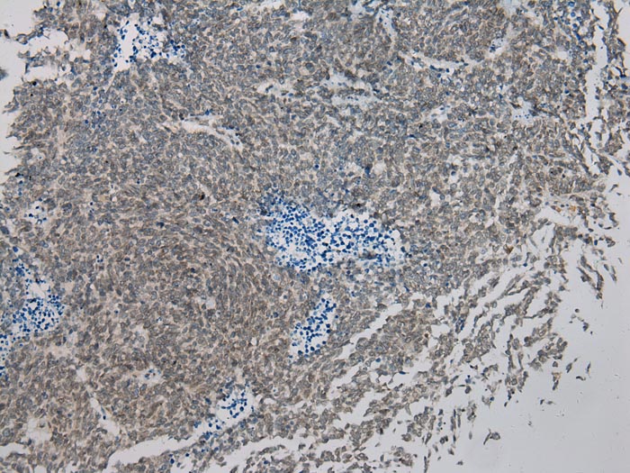 IL-20 Antibody