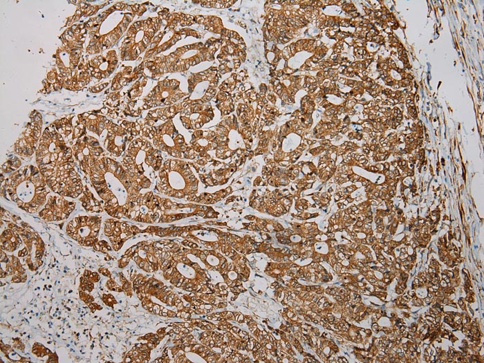 TXNDC5 Antibody