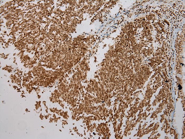 ULBP1 Antibody