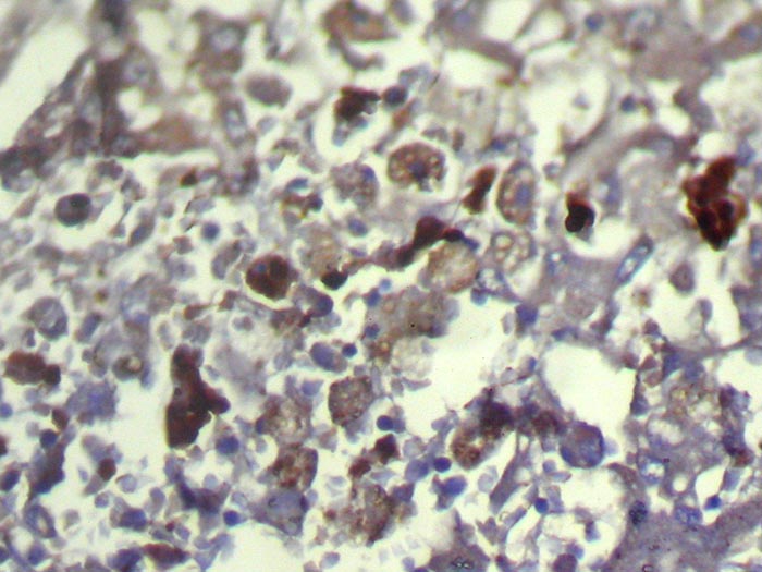 TXNDC11 Antibody