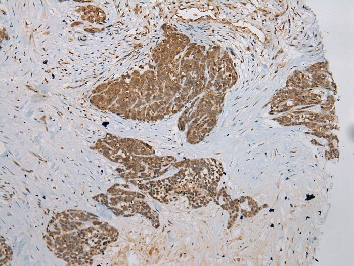 DCAF7 Antibody