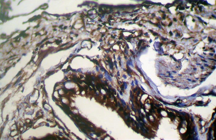 WFDC5 Antibody