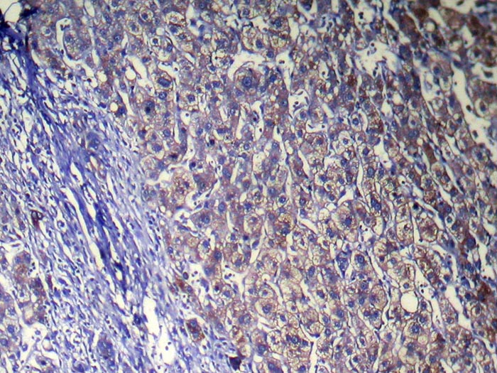 ZFAND5 Antibody