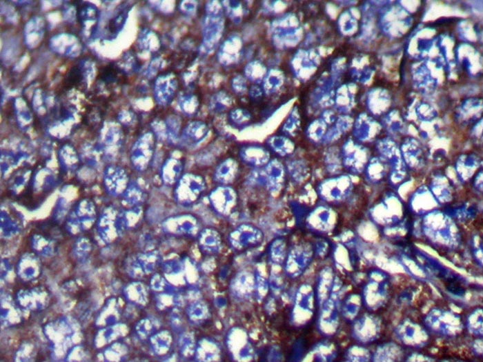 ZFP91 Antibody