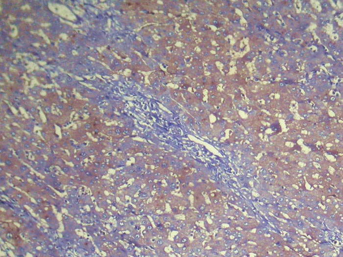 NUDT2 Antibody