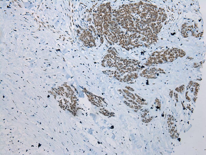 ZNF22 Antibody