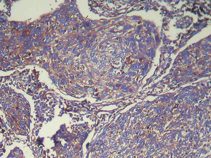 ATP6V1E2 Antibody