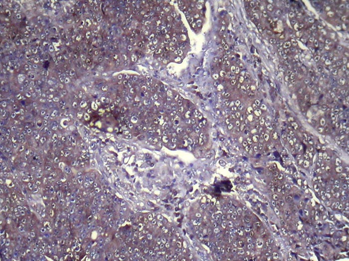 GLIPR1L1 Antibody