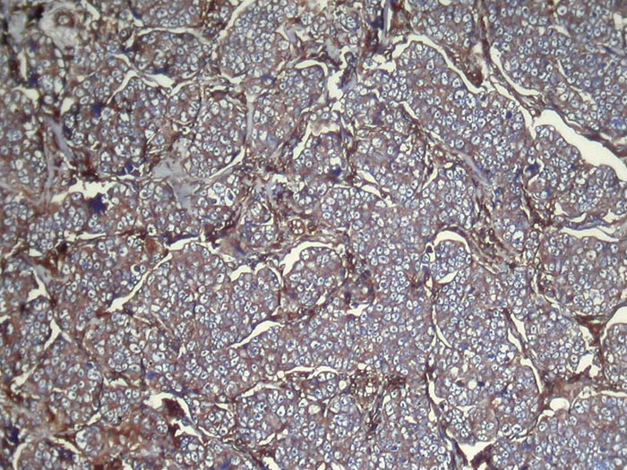 UGT3A1 Antibody