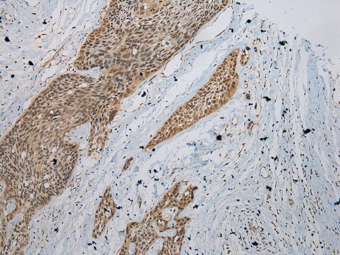 ZBTB2 Antibody