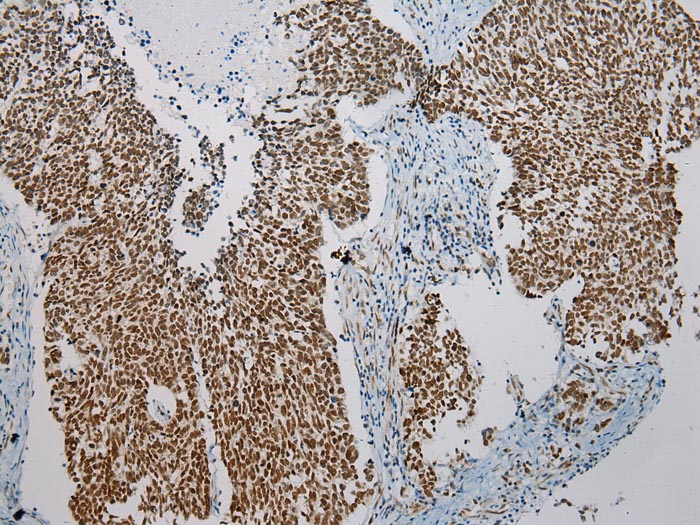 ZNF473 Antibody