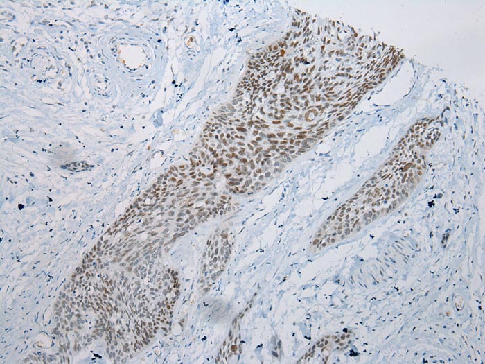 ARFGAP2 Antibody