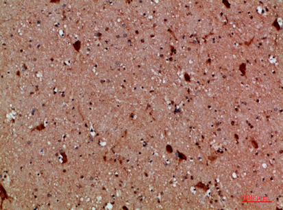 Calretinin Polyclonal Antibody