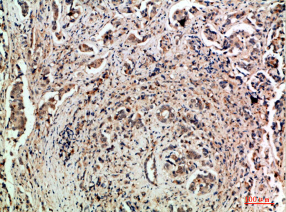 TLE1/2/3/4 Polyclonal Antibody