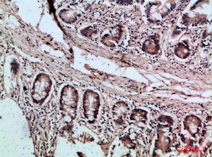 Villin Polyclonal Antibody