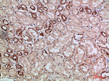 Villin Polyclonal Antibody