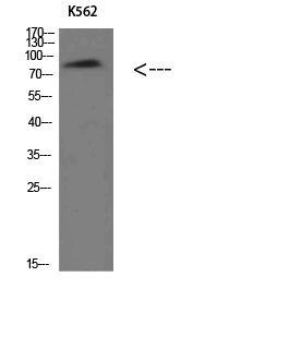 Villin Polyclonal Antibody