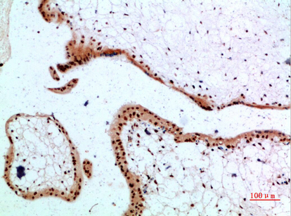 TGFβ RIII Polyclonal Antibody