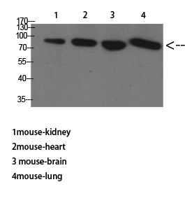 TGFβ RIII Polyclonal Antibody