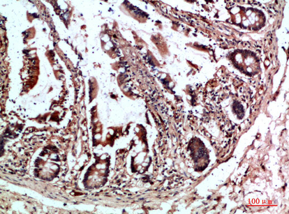 CYFIP2 Polyclonal Antibody