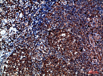 CYFIP2 Polyclonal Antibody