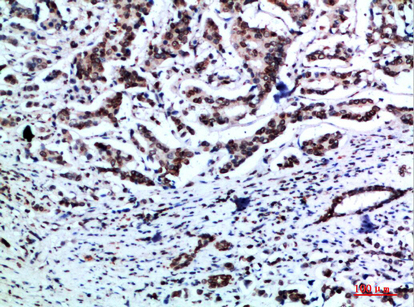 Vimentin Polyclonal Antibody