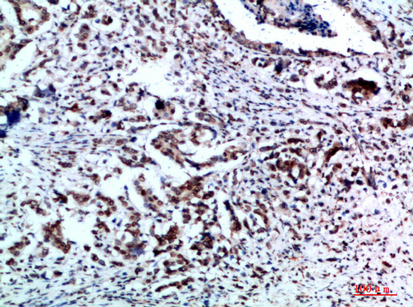 Vimentin Polyclonal Antibody