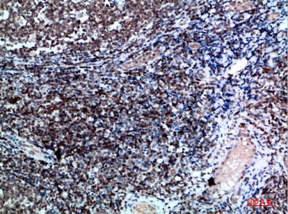 Vimentin Polyclonal Antibody