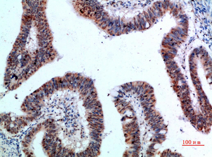 TyrRS Polyclonal Antibody