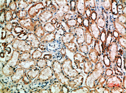 TyrRS Polyclonal Antibody