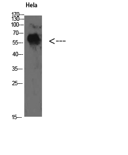 TyrRS Polyclonal Antibody