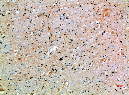 SPOP Polyclonal Antibody