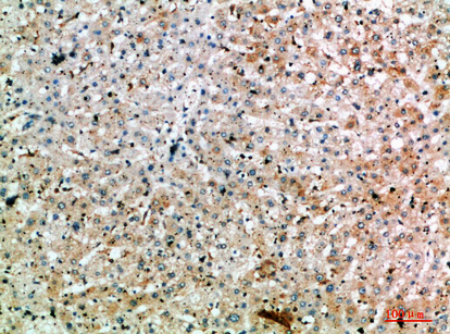 SPOP Polyclonal Antibody