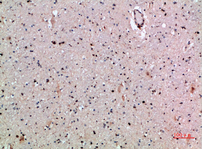 CLECSF6 Polyclonal Antibody