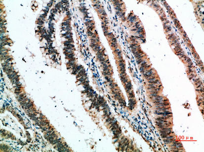 CLECSF6 Polyclonal Antibody