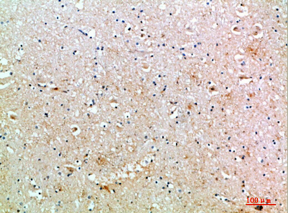 MIB1 Polyclonal Antibody