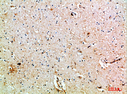 MIB1 Polyclonal Antibody