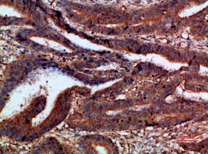 p120 Polyclonal Antibody