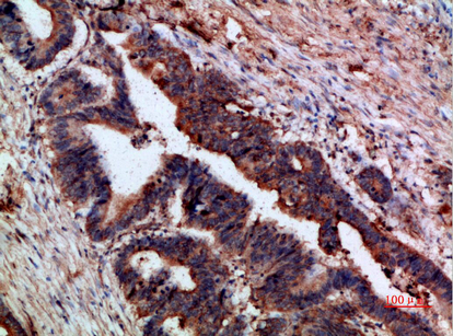 p120 Polyclonal Antibody